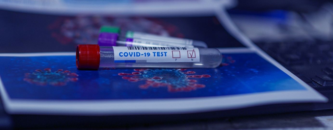 Vial with COVID-19 Test written on side